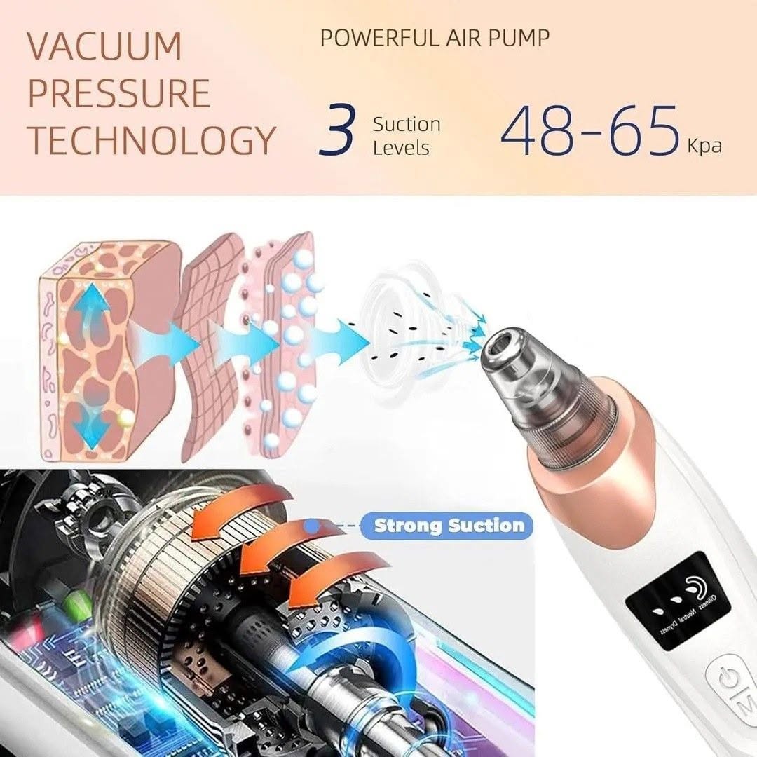 Electric Blackhead Remover & Pore Vacuum Suction Cleanser