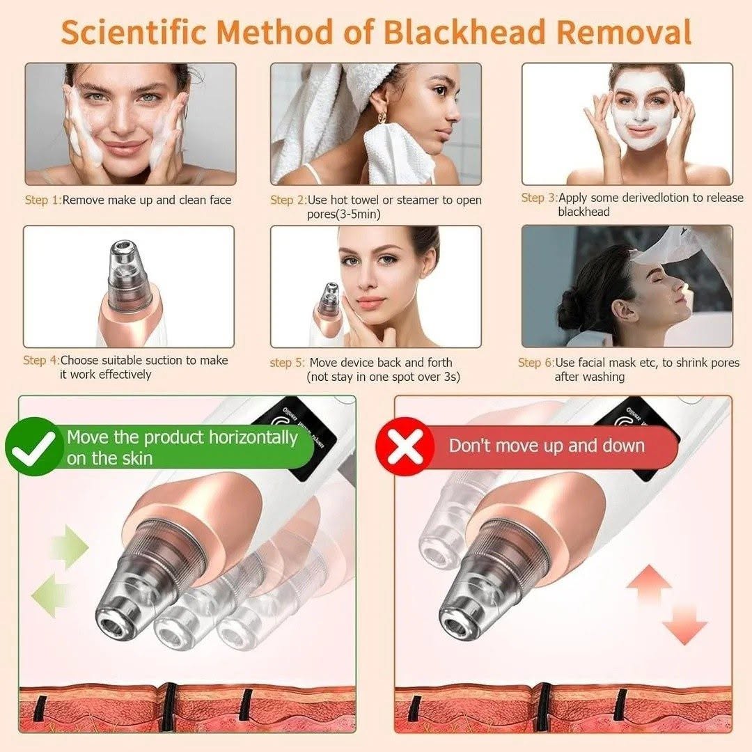 Electric Blackhead Remover & Pore Vacuum Suction Cleanser