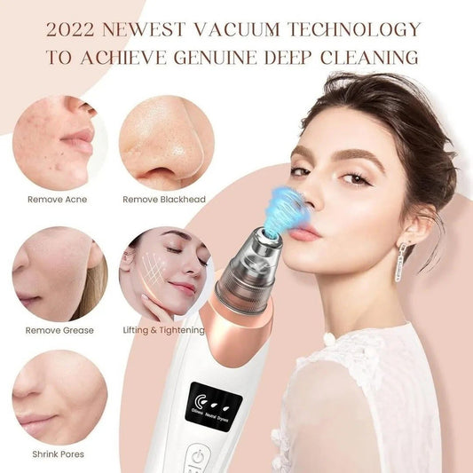 Electric Blackhead Remover & Pore Vacuum Suction Cleanser